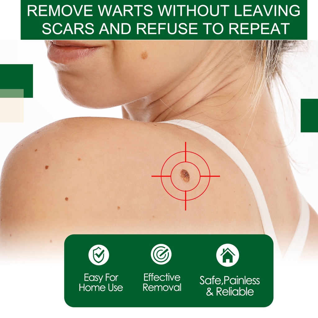 South Moon Skin Tag Remove Liquid Treatment Papillomas Removal Of Warts ...
