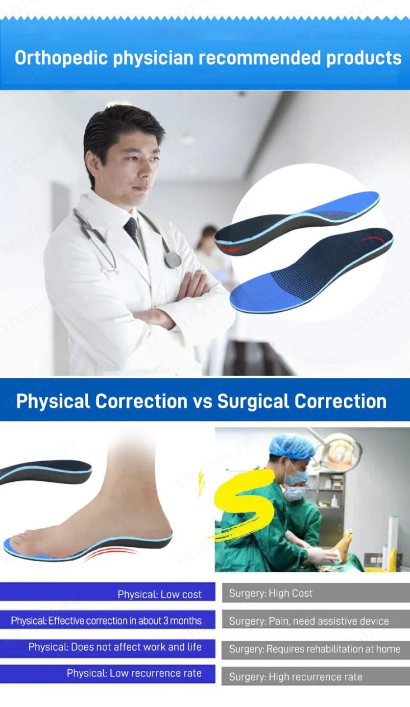 Flat foot valgus , bunion, and XO leg correction insoles | Shopee ...