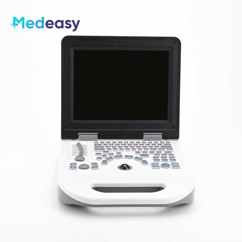 LY 12 Inch Portable White And Black Ultrasound Pregnancy Scanner ...