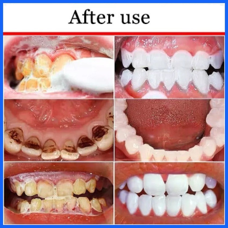 HUNMUI Fresh Breath Toothpaste Teeth Whitening Foam Cleansing Mouth ...