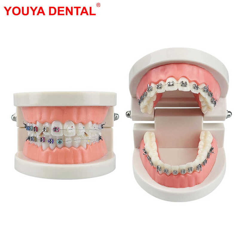 LY Dental Orthodontic Teeth Model With Braces Dental Ching Model Metal ...