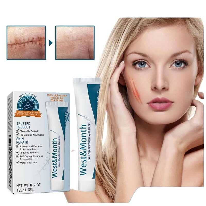 Scar Recovery Cream - Fast Repair For Surgery Scars, Stretch Marks ...