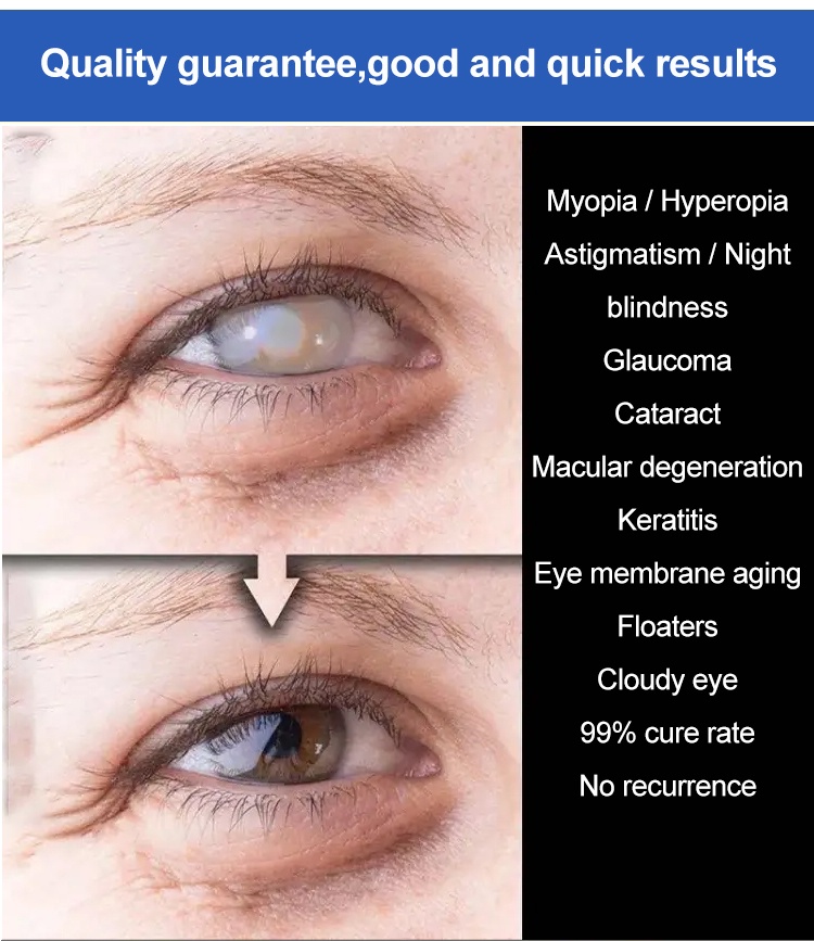 ⚡PH HOT⚡【Eye care eyesight-improving eye drops】Eye Drops for Eye ...