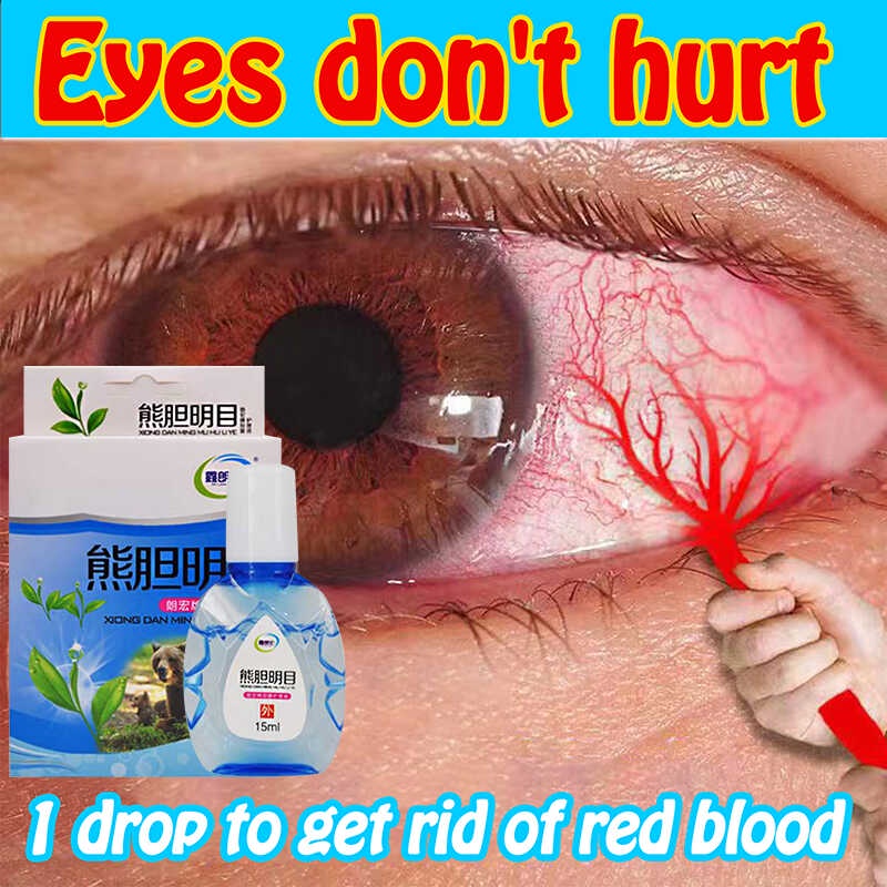 Eye Drops Itchy Eyes Relieves Red Eyes Discomfort Glaucoma Eye Drops 