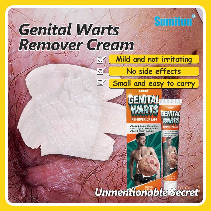 100 Effective Genital Warts Remover Original Cream Genital Herpes Condyloma Skin Tag Shopee 6524