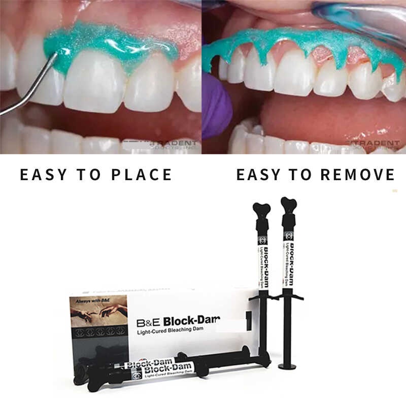 Dental Block Out Resin Light Curing Blue Gingival Barrier Resin Para Sa Teeth Whitening Gum