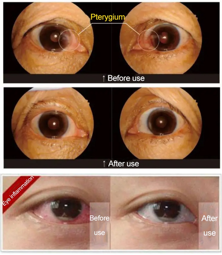 ⚡PH HOT⚡【Eye care eyesight-improving eye drops】Eye Drops for Eye ...