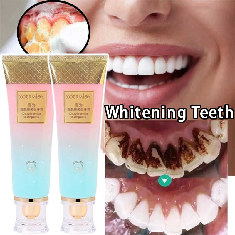 Niacinamide Whitening Toothpaste 100G Aqua Cool Improves Yellow Teeth ...