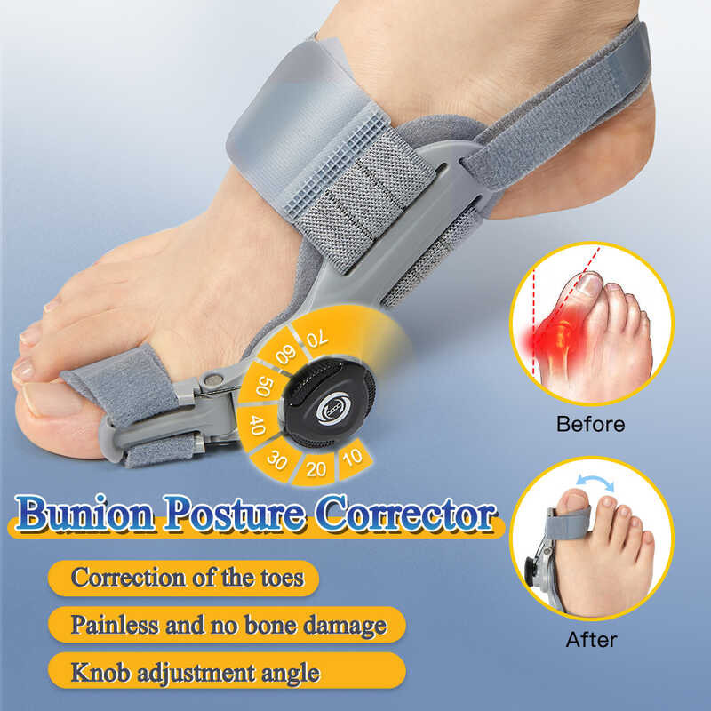 Bunion Corrector Foot Posture Corrector Foot Relief Hallux Valgus Toe ...