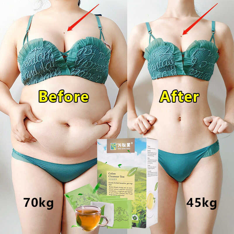 20Pcs/Set 7 Days Effective Slimming Tea Herbal Thin Belly Tea Not