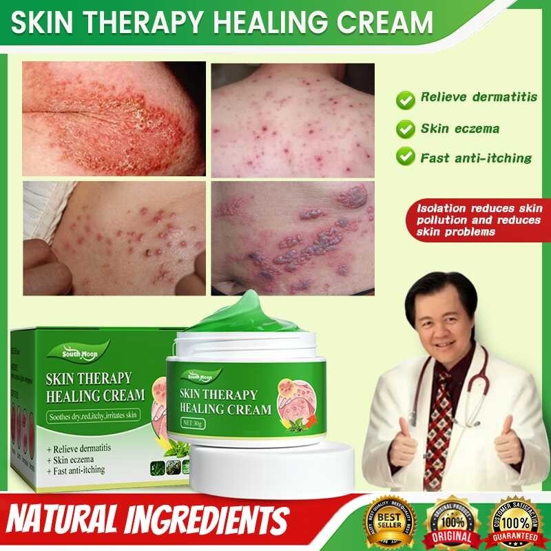 Gamot Sa Kati Kati Sa Balat Skin Fighter Atoderma Cream Original 