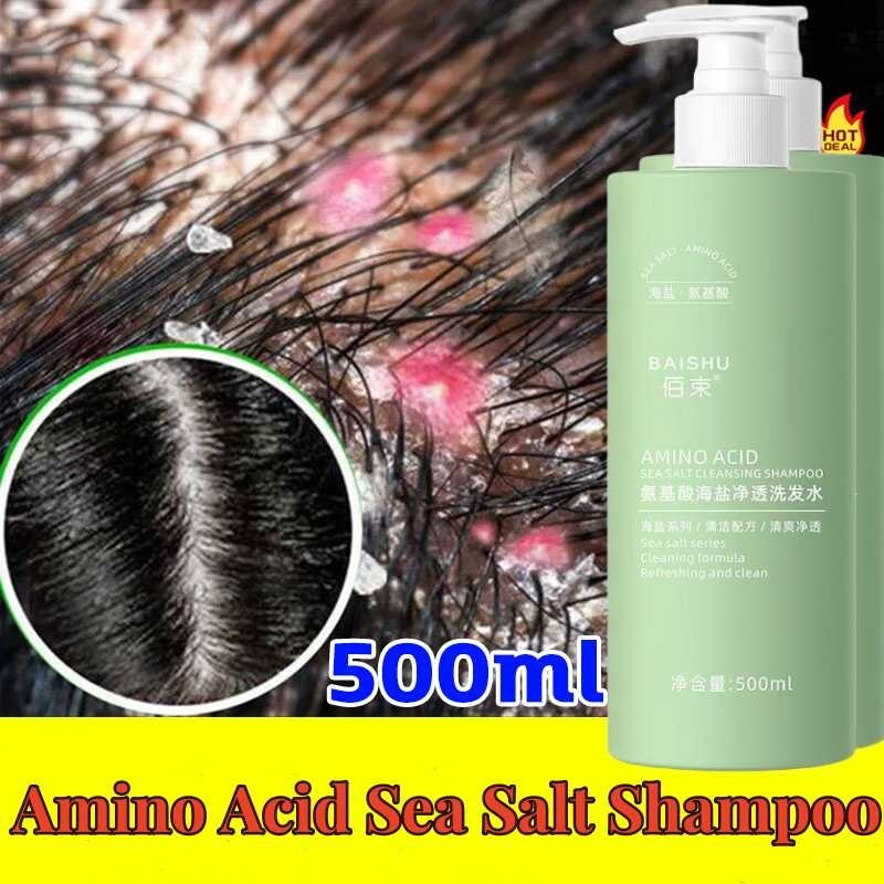 Sea Salt Shampoo 500ml Anti Dandruff Shampoo Para Sa Psoriasis Para Sa Scalp Itching Hair