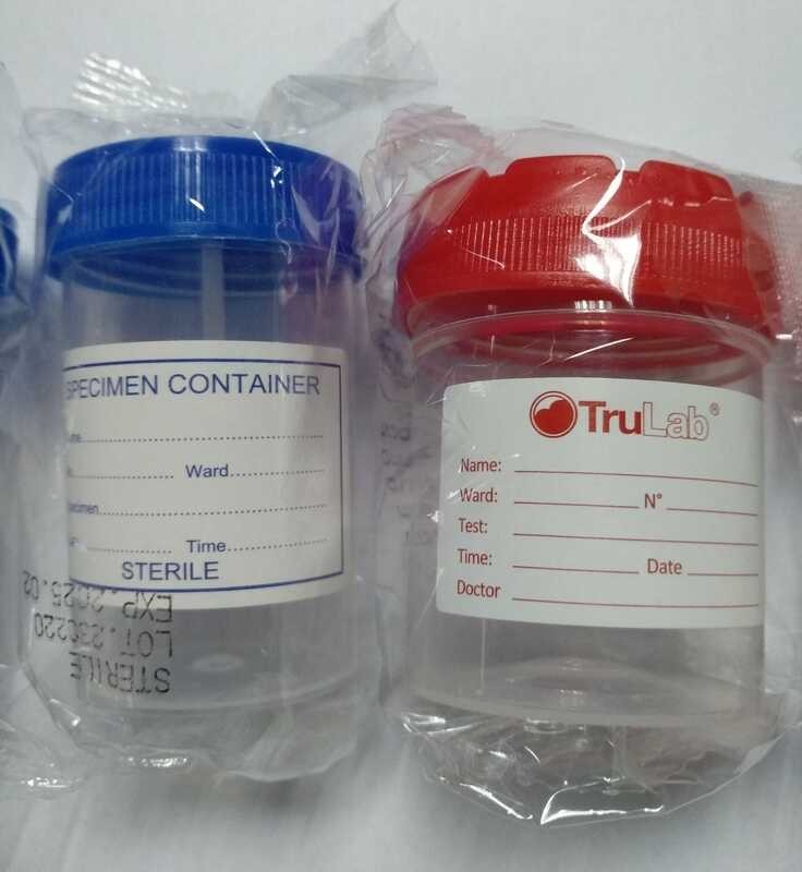 Specimen Container ( Urine & Stool )( per piece ) | Shopee Philippines
