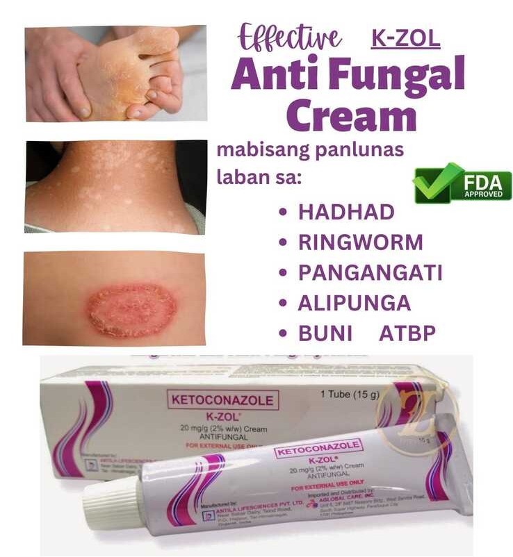 EFFECTIVE Anti fungal Cream K.ZOL. LUNAS PARA SA HADHAD BUNI RINGWORM ...