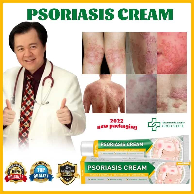 Atoderma Cream Original Gamot Sa Kati Kati Sa Balat Ointment Eczema ...