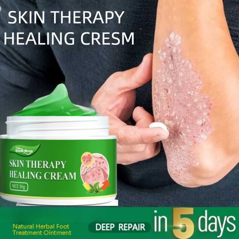 gamot sa kati kati sa balat ointments for skin deases eczema treatment