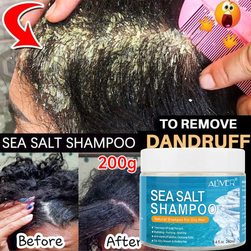 ALIVER Sea Salt Shampoo Anti Dandruff Hair Treatment Shampoo Para Sa ...