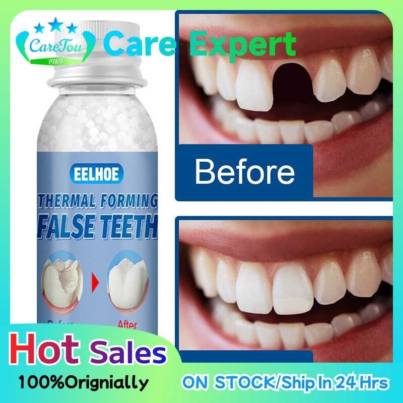 Temporary dentures with solid dental glue for instant perfect filling