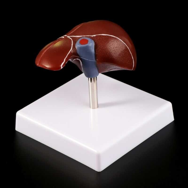 LY ♛ Props Model Human Liver Pathological Anatomical Model Anschool ...