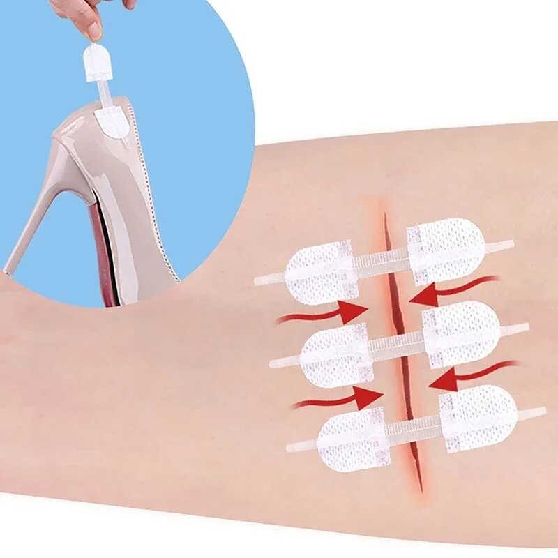 LY 3Pcs Zipper Tie Wound Closure Patch Hemostatic Patch Wound Fast ...