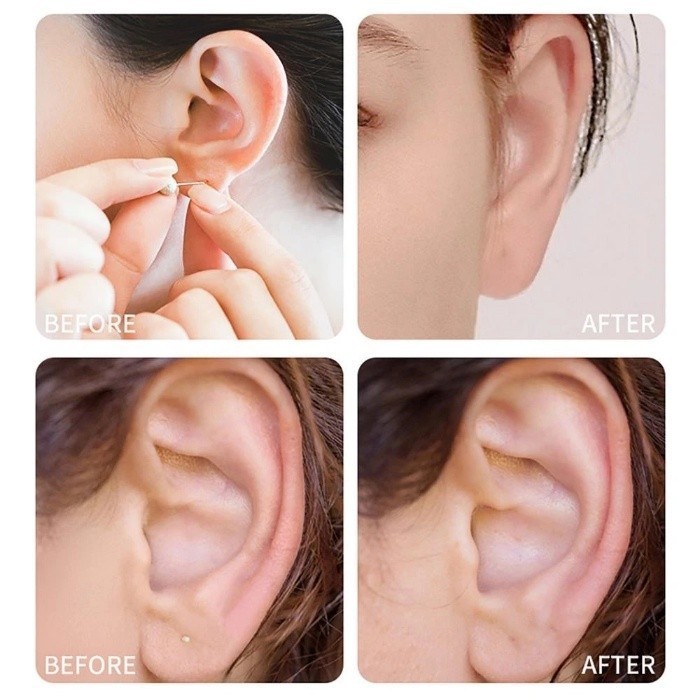 Disposable Ear Hole Cleaning Set Safe Ear Piercing Cleaning Solution ...