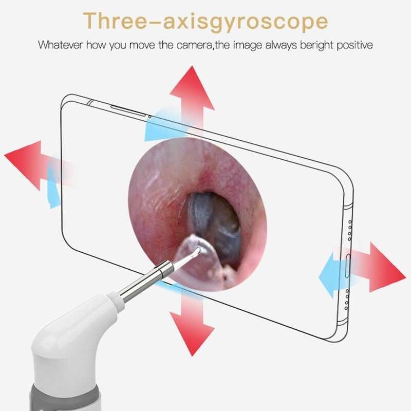 LY Wifi Otoscope Visual Ear Endoscope Camera Ear Wax Cleaner Camera For ...