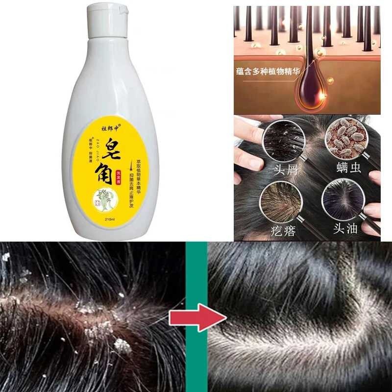 210Ml Scalp Cleaning Shampoo Dandruff Seborrheic Follicles
