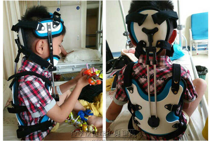 Head And Neck And Chest Orthosis Brace Children's Torticollis ...