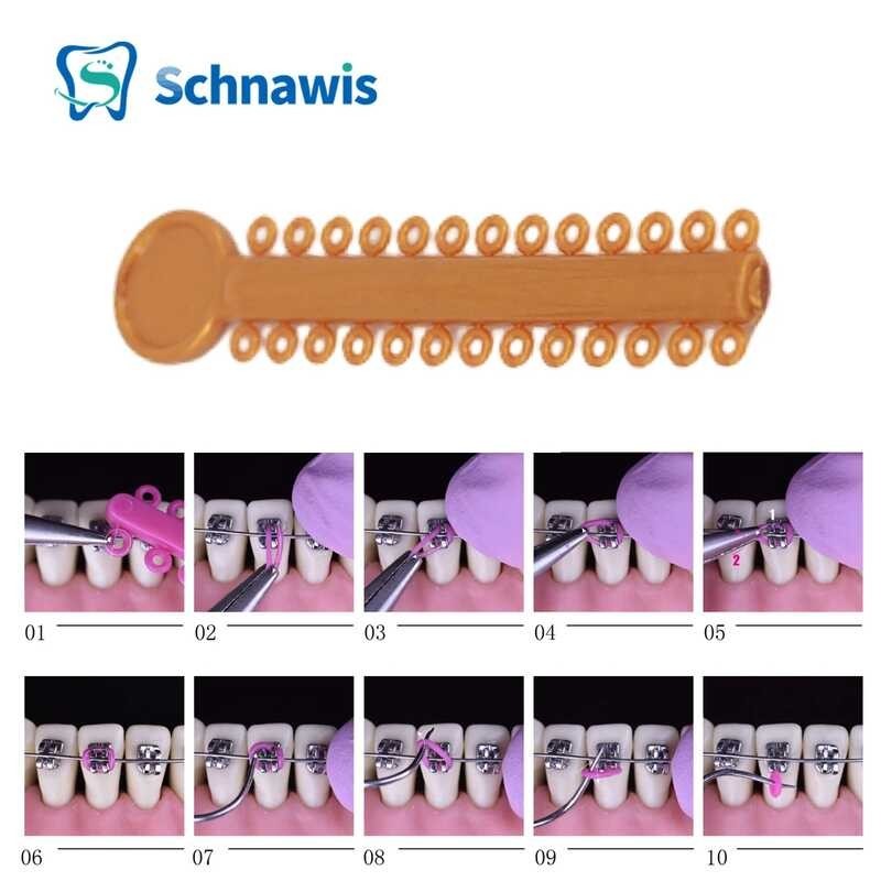 Orthodontic Ligature Ties Dental Cartoon O-Ring Cat Flower Mouse ...