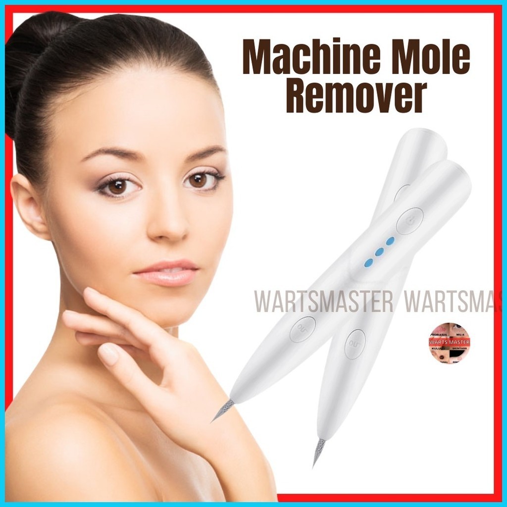 ☂ ♨ [ WARTSMASTER ] Mole Removal Machine | BEST Use for Removing Spot ...