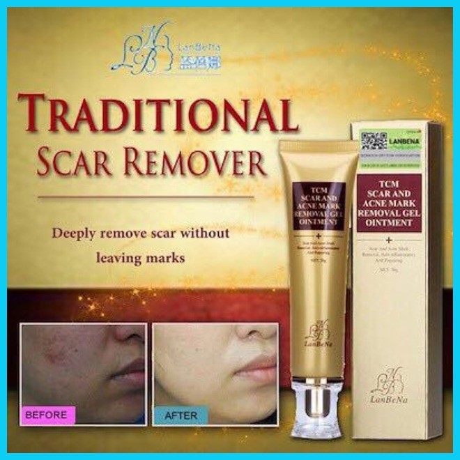 Authentic TCM scar and ACNE mark Removal gel ointment | Shopee Philippines