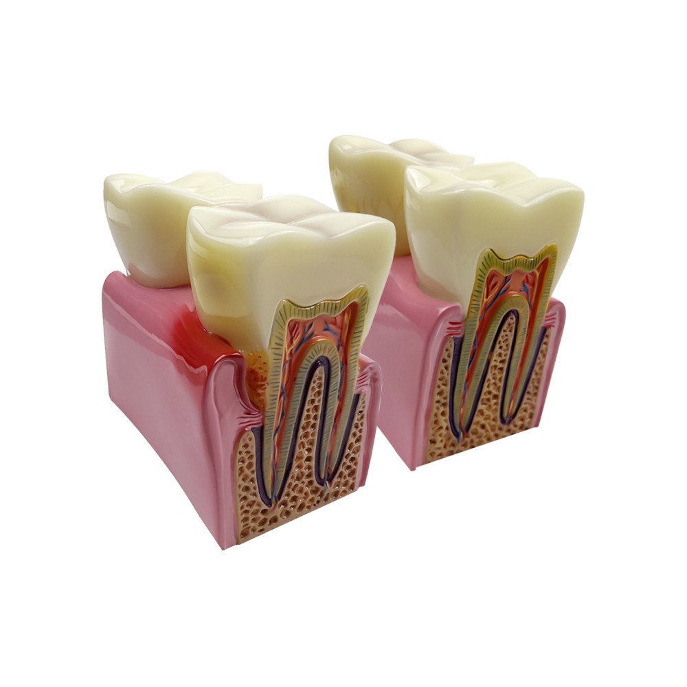 Big Teeth Anatomy Large Dental Anatomical Model For Teaching Studying ...