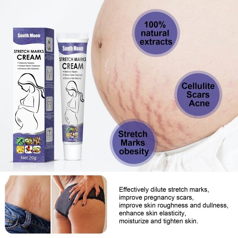 South Moon Stretch Mark Removal Cream Birthmark Burn Cesarean Surgical ...