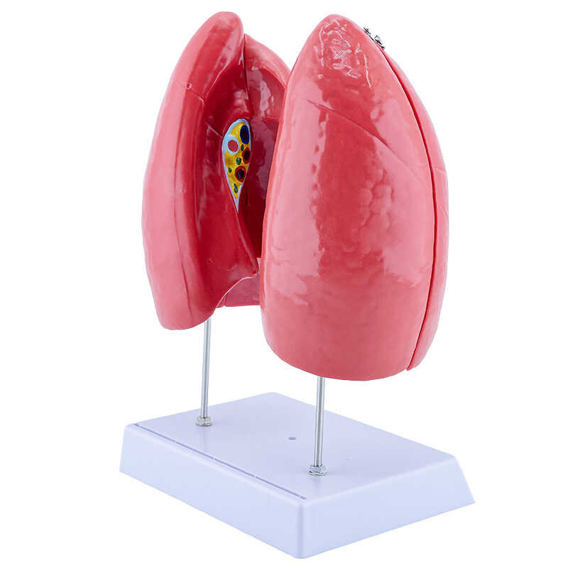 Pathological Lung Human Lung Anatomy Model Respiratory System Teaching ...