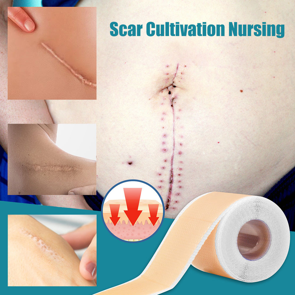 SALORIE Self-Adhesive Silicone Scar Sheet Removal Scar Tape Therapy ...