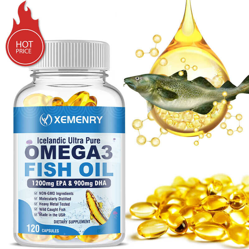 3 OMEGA FISH OIL para sa utak puso joint skin at immune support