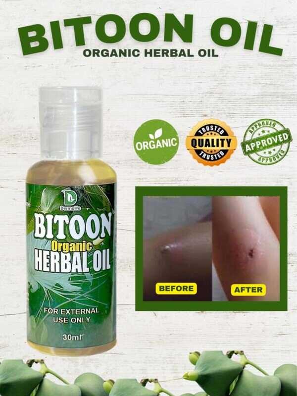 BITOON Herbal Oil - Natural Solution For Lumps And Bumps, 30Ml Bottle ...