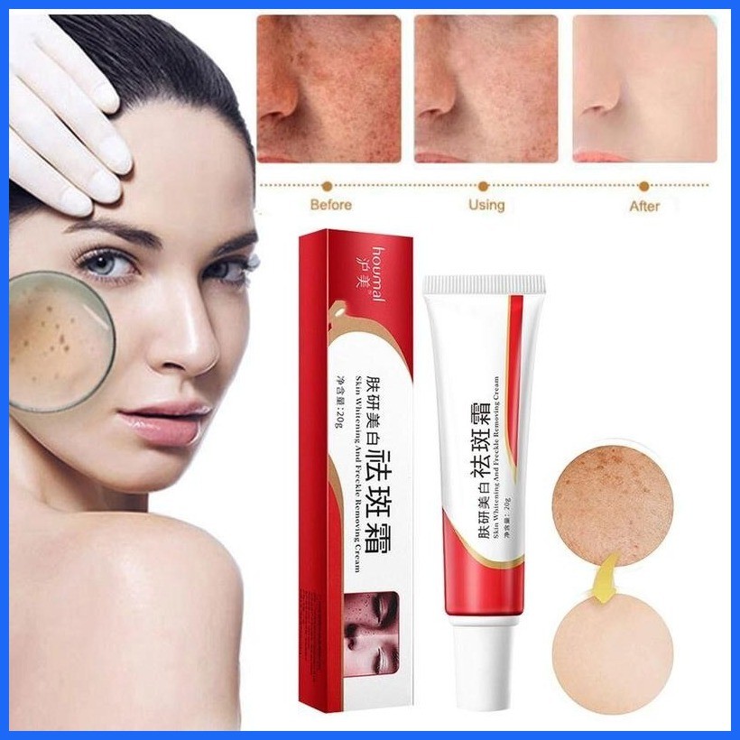 Set Of 3pcs Melasma Cream Pekas Collagen Japan Pekas Remover Original ...