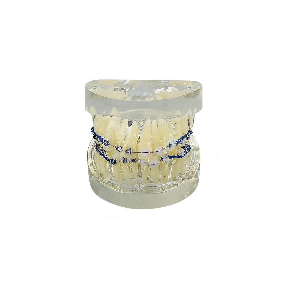 Orthodontic Dental Treatment Teeth Model Teaching Study Gum Tooth ...