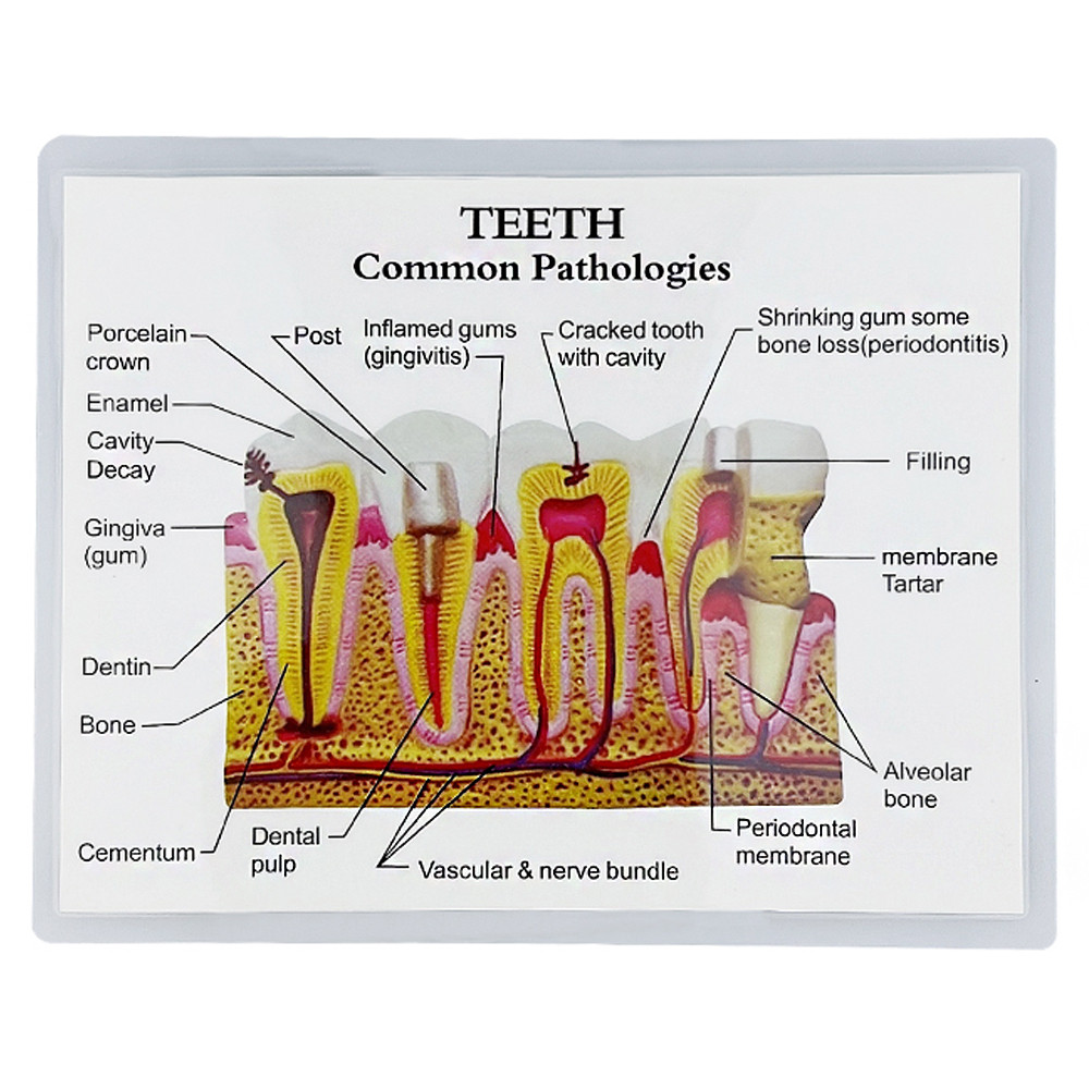 Anatomical Structure Standard Teeth Teaching Student Demonstration ...