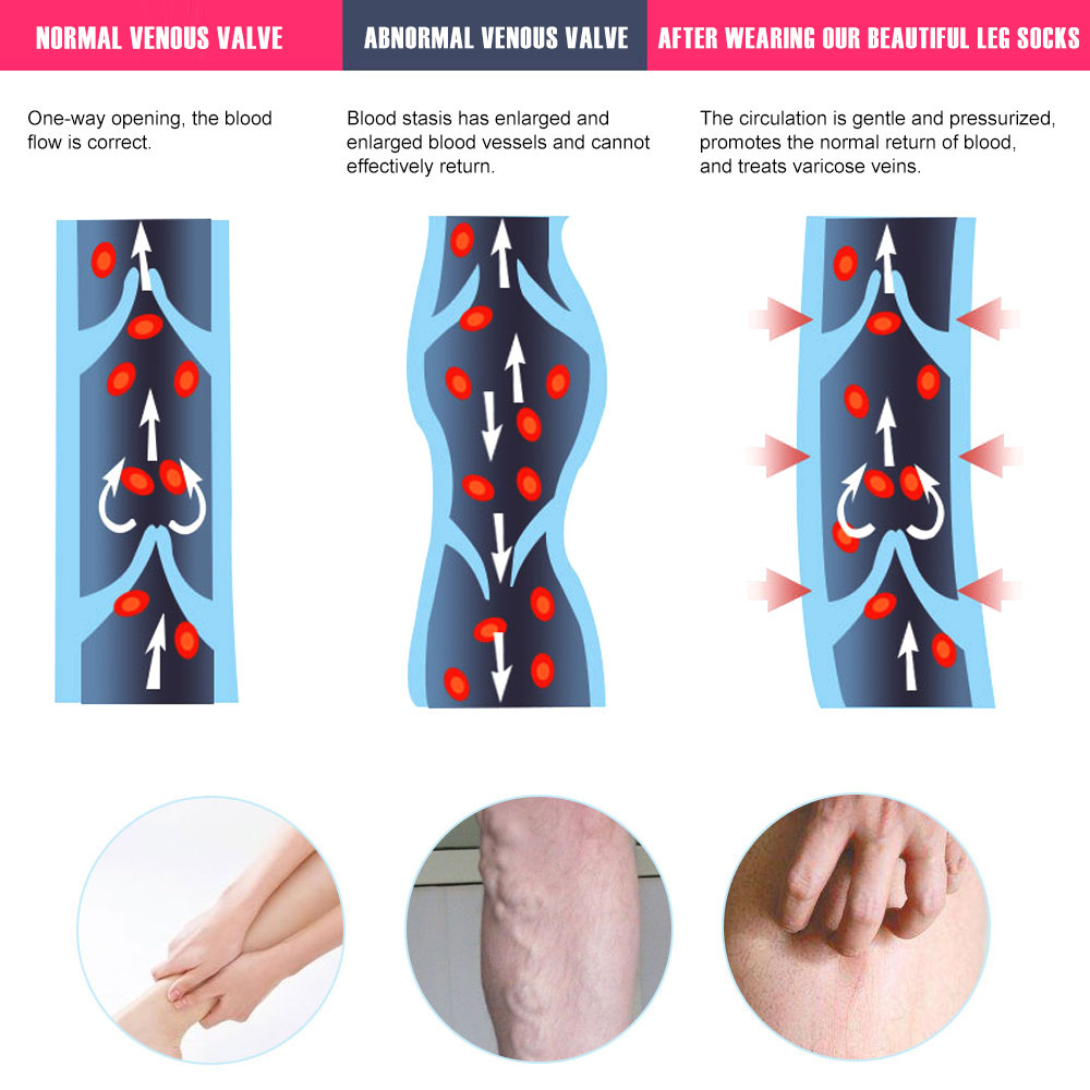 1 Pair Thigh High Footless Compression Sleeves with Silicone Band, 20