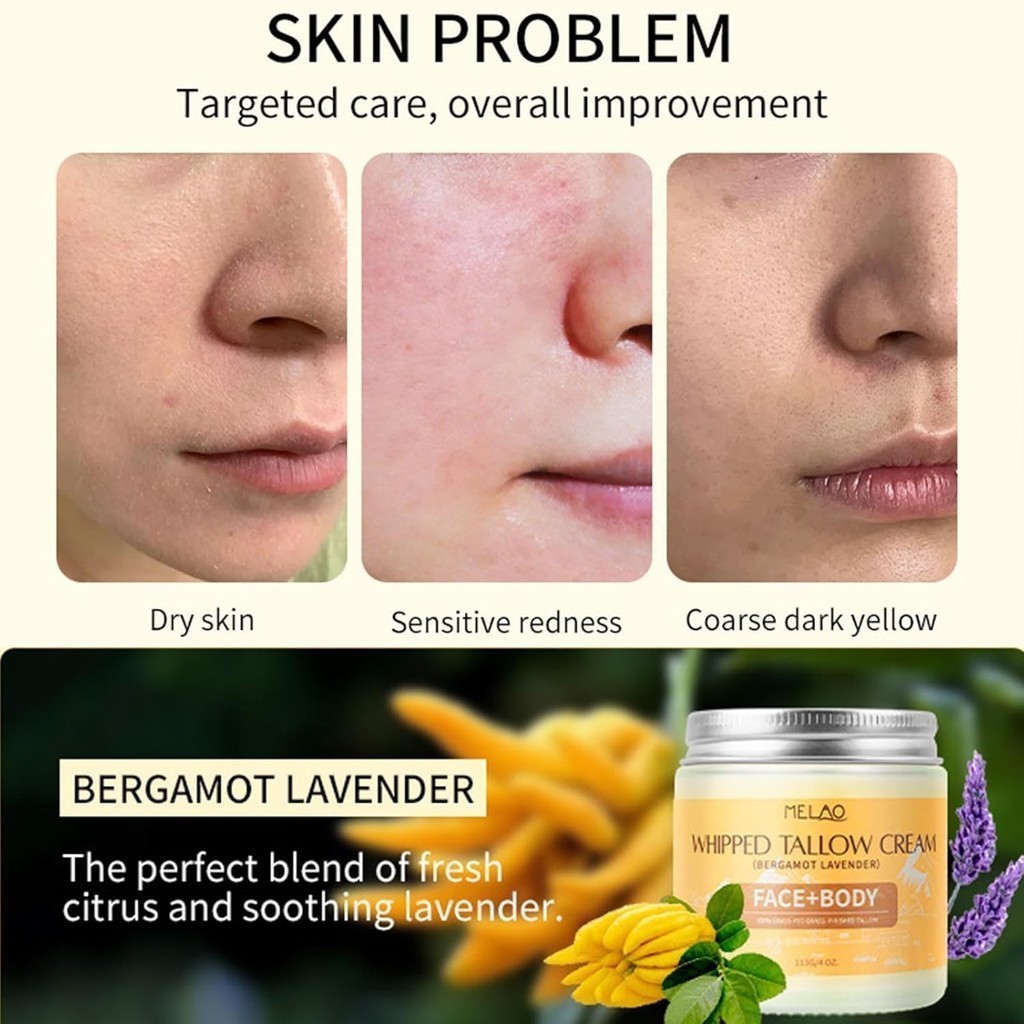 Beef Tallow,Beef Tallow Balm for Skin Care,Grass Fed Tallow & Honey ...