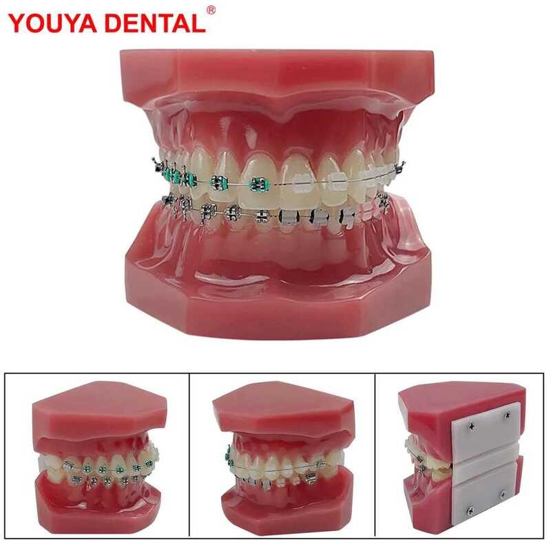 Dental Normal Orthodontic Teeth Model With Brace Half Metal Half ...