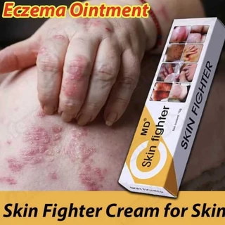 Shop skin fighter cream for Sale on Shopee Philippines