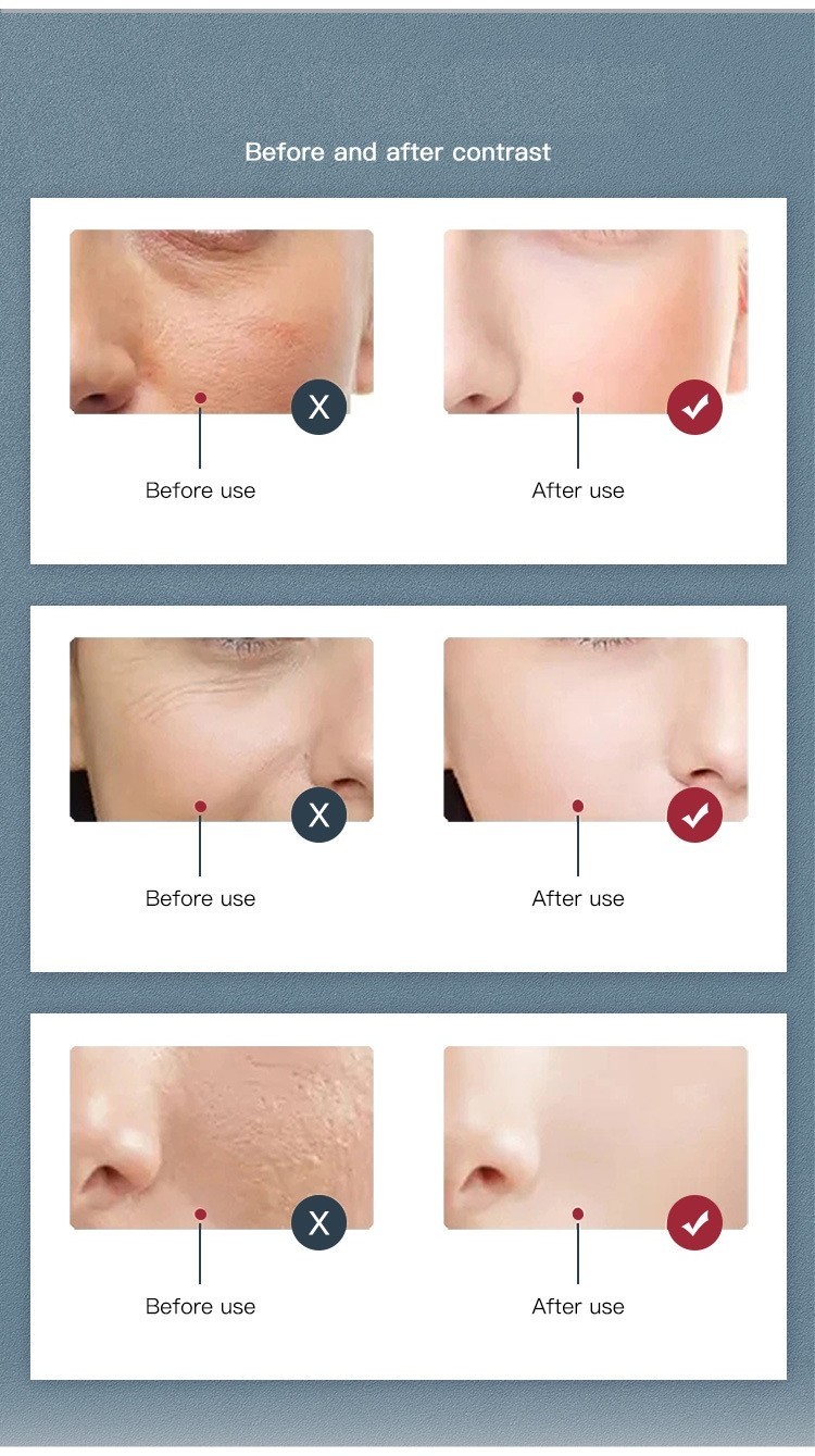 RU-8201 Microcurrent Bio-Lift Pro Spa Facial Ultrasonic Skin Care ...