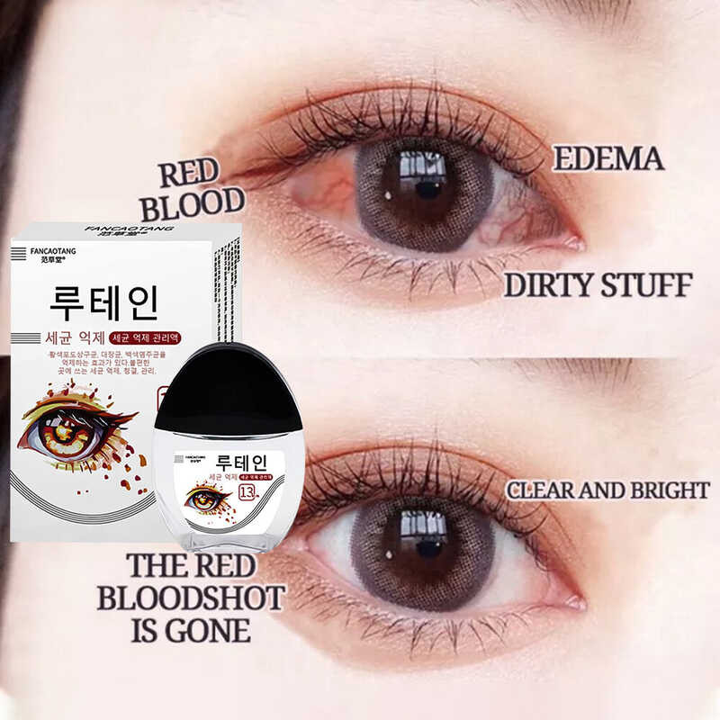 Korea Itchy Dry Eye Drops Sore Eyes Shopee Philippines