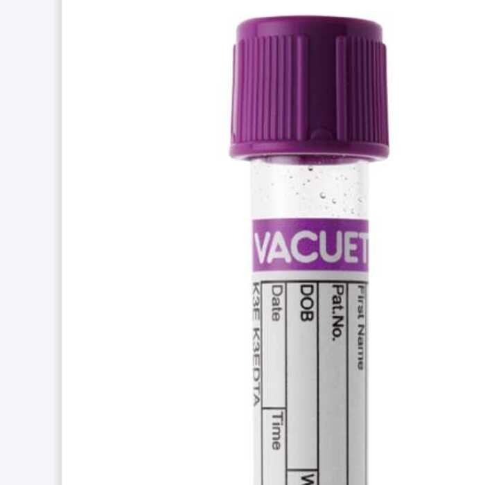Item number 454317 Transparent Label - Direct Extraction Tube 13x75 ...