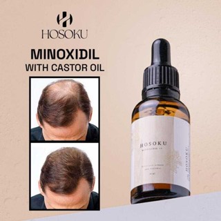 hosoku minoxidil Best Prices and Online Promos Nov 2025