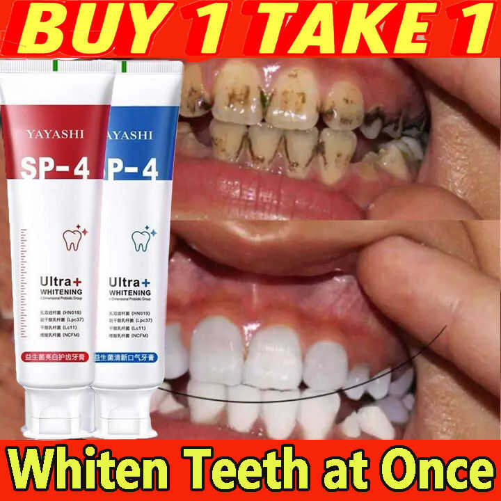 【Buy 1 TAKE 1】Probiotic Caries Toothpaste Sp-4 Whitening Tooth Decay ...