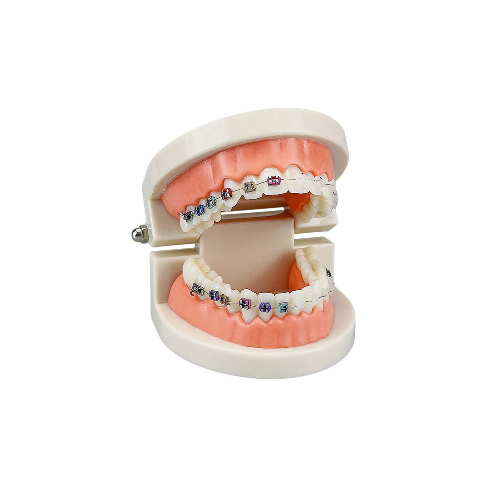 Teaching Standard Dental Orthodontic Teeth Model With Braces Metal ...